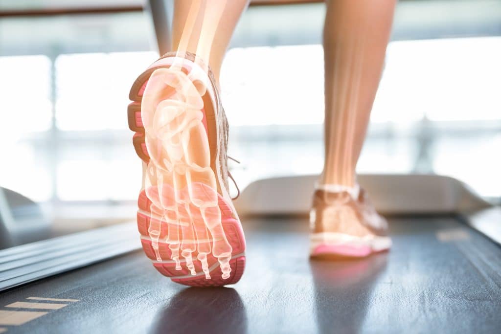 heel spurs