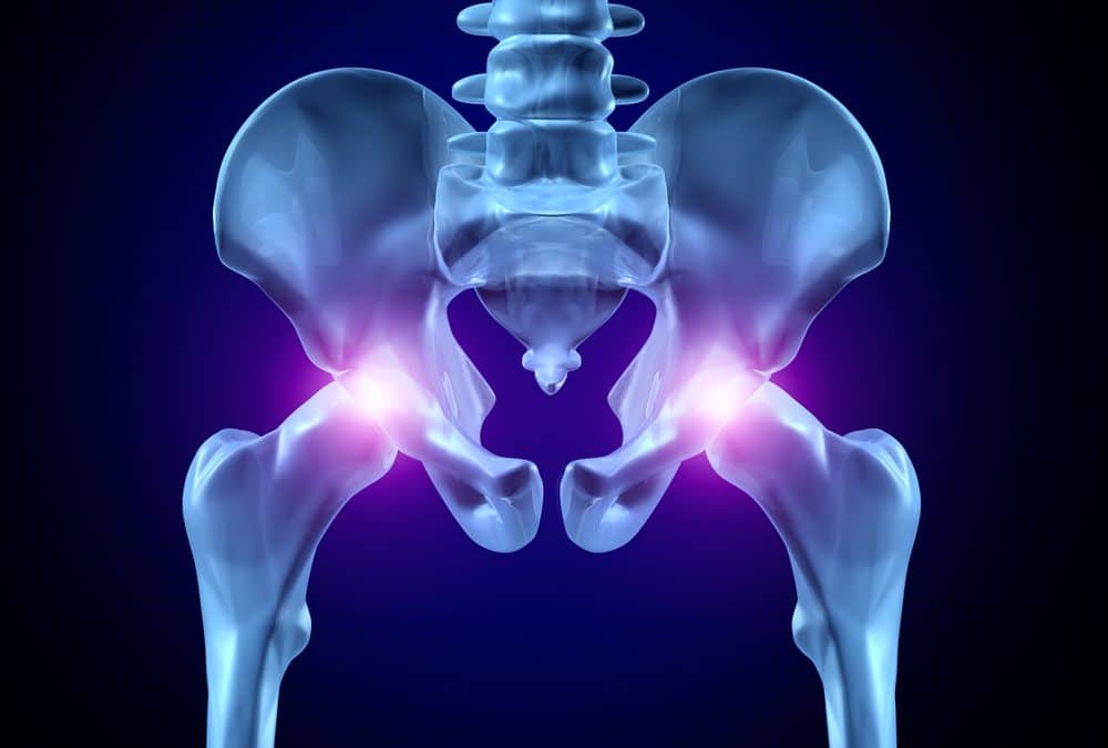 hip pain blog image for amazing life chiropractic and wellness in mill creek