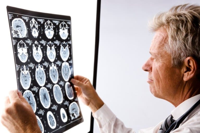 Picture of a Neurologist reviewing brain imaging before teaming with Amazing Life Chiropractic and Wellness in Mill Creek on a head injury patient.