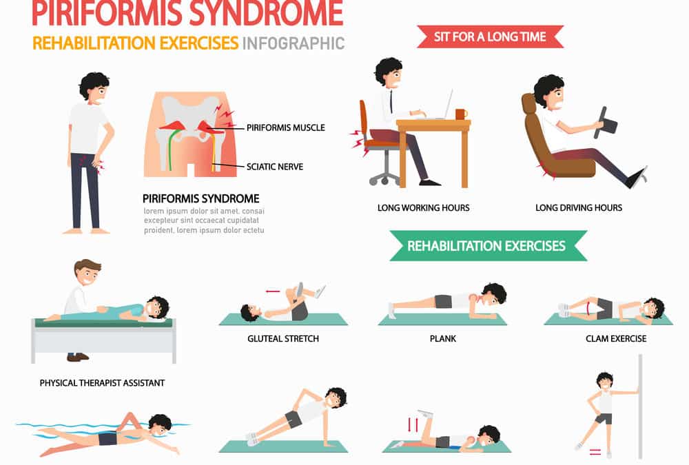 How to Sleep with Piriformis Syndrome - Vive Health