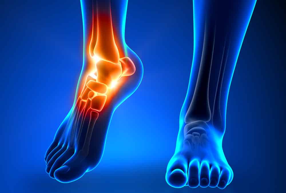 Swollen Feet During Pregnancy