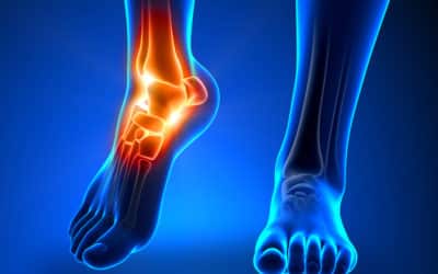 Swollen Feet During Pregnancy