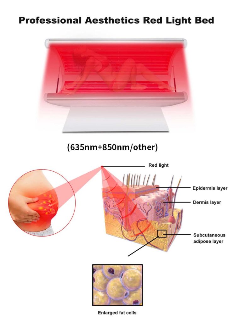 fat cells