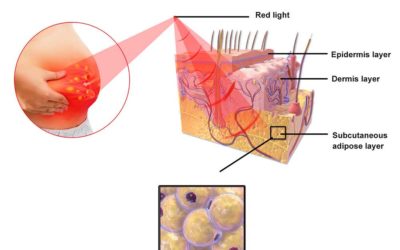 How Red Light Therapy Targets Fat Cells