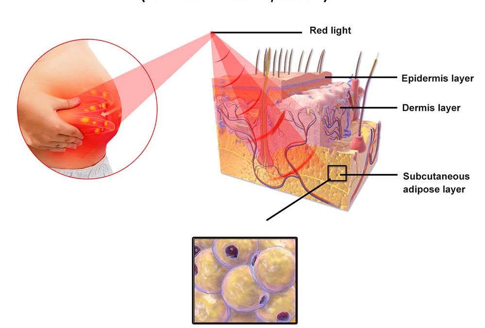 How Red Light Therapy Targets Fat Cells