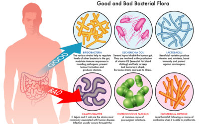 4 Easy Ways How to Improve Gut Health