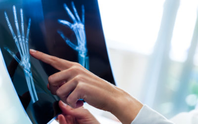 X-Rays: Why We Use Them and Why We Don’t