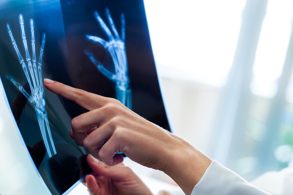 Close up of female doctors hands pointing at x-ray sheet in clinic.